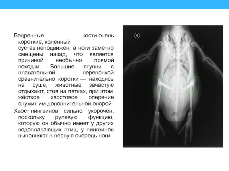 Бедренные кости очень короткие, коленный сустав неподвижен, а ноги заметно смещены назад, что является причиной необычно прямой походки. Большие ступни