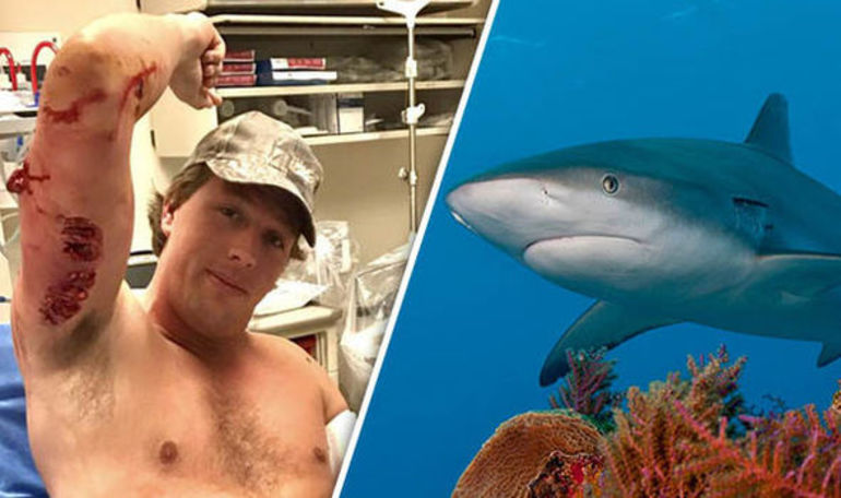 Нападение акул на человека