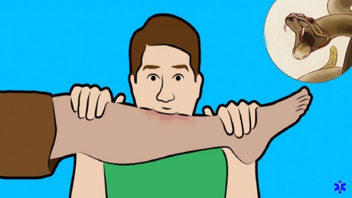 При укусе змеи высосать яд из ранки