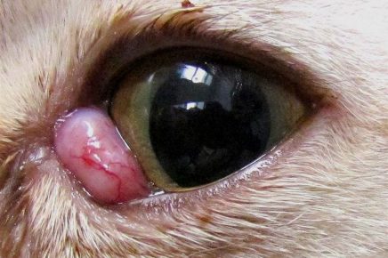 Аденома третьего века