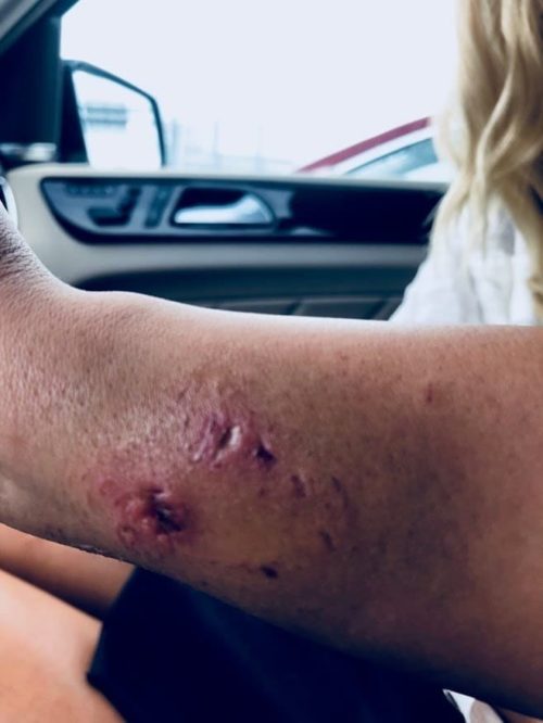 Укус мурены