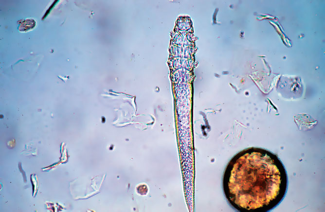 демодекс под микроскопом