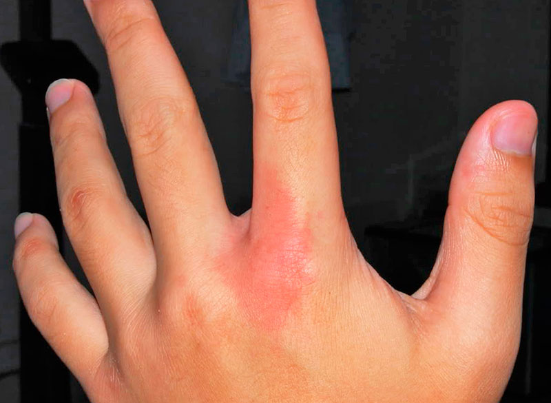 сколопендра фото насекомое