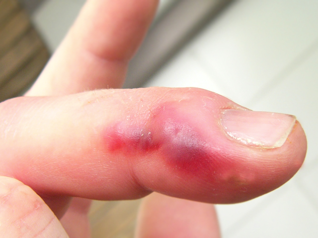 скалапендрийский дом