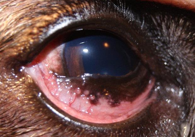 Фолликулярный конъюнктивит