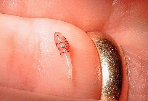Маленькая личинка овода в организме человека