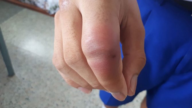 Пчела-плотник: как ее узнать и стоит ли ее бояться